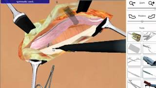 Hernia Repair  Open Surgery Simulation [upl. by Irec]