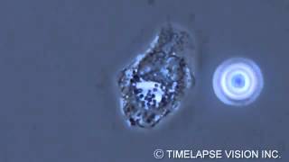 Bacterial phagocytosis by neutrophils [upl. by Elysha]