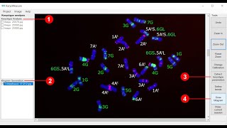 Karyotype analysis using KaryoMeasure [upl. by Adlen69]