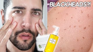 Testing An Esthetician Approved Oil Cleansing Routine  OIL PLUGS BLACKHEADS ✖ James Welsh [upl. by Lehcer]