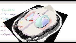 Basal Ganglia 3D Tour [upl. by Fredrick846]